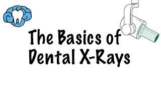 How to Read Dental X-Rays