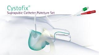 Cystofix Suprapubic Catheter Puncture Set