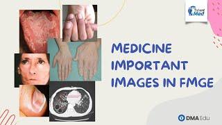 Medicine Important images in FMGE | Medicine Most Expected Images in FMGE/NEET-PG | DMA