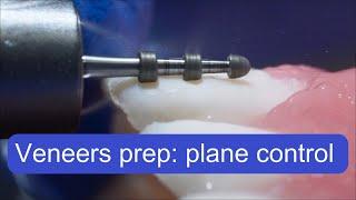 Veneers preparation technique