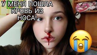 МОЕ УТРО у меня пошла кровь из носа! [видео kristina_patrash]