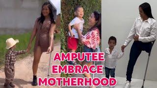 Amputee woman | adaptive crutches user life: Embracing motherhood