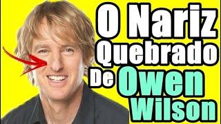 PORQUE O NARIZ DE OWEN WILSON É DEFORMADO | Saiba como Owen Wilson Quebrou o Nariz!.  Owen Wilson