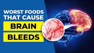 6 Worst Foods that Cause Brain Bleeds