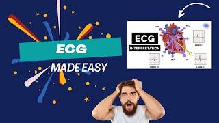 ECG EXPLAINED: Simplified Guide to Master Electrocardiography