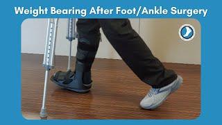 Weight Bearing After Foot Surgery