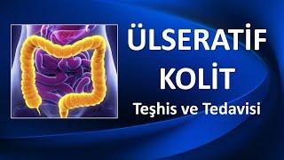 ÜLSERATİF KOLİT NEDİR? NASIL TEDAVİ EDİLİR?