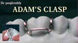 Adams clasp |Adams clasp fabrication |Dr poojireddy