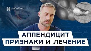 Как распознать аппендицит? Первые симптомы и диагностика / Hadassah Medical Moscow