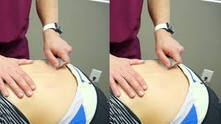 Adhesion treatment in tissues that limit your mobility | Avail Soft Tissue & Spine | Colorado