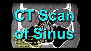 How To Read CT Sinus Scans Like An Expert