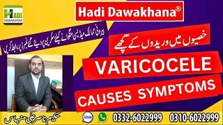 Cure Testis Pain Naturally Without Surgery | Natural Treatment For Varicocele Pain Relief