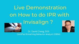 How to do IPR with Invisalign?