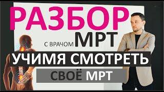 Разбор МРТ при межпозвоночной грыже. Алексей Фещенко (Темед, Казань)