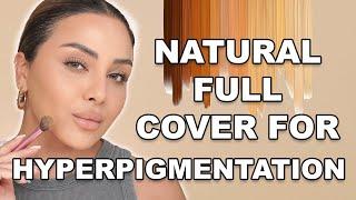 Full Coverage Flawless Makeup for Hyperpigmentation | Nina Ubhi