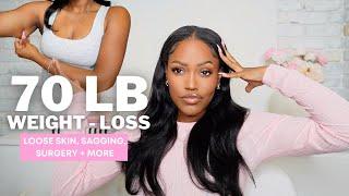 70 LB WEIGHT-LOSS BODY CHANGES + TIPS | LOOSE SKIN, SAGGING, STRETCH MARKS + MORE