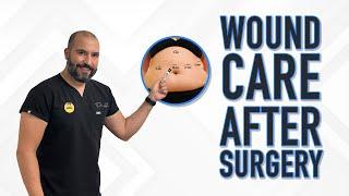 Wound Care After Surgery 🩹 | Gastric Sleeve Surgery | Questions & Answers