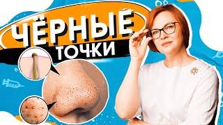 Черные точки и прыщи. Как от них избавиться?