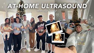 AT-HOME ULTRASOUND WITH OUR ENTIRE FAMILY!