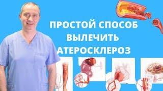 Как вылечить атеросклероз?