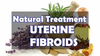 My Natural Treatment For Uterine Fibroids | Jovanka Ciares