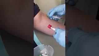 Venepuncture