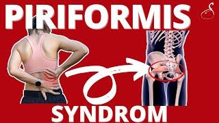 Piriformis Syndrom nur ein Mythos? - Was hilft wirklich? │ SanoGym