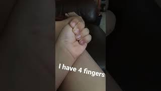 I have 4 fingers!