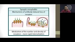"Autoimmune Encephalitis-Clinical presentation and Management"-Lecture