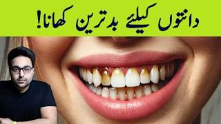 Dr. Zee:The Worst Food for Your Teeth Is NOT SUGAR | डॉक्टर ज़ी