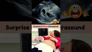 Biggest but Best Surprise  Twins on First Pregnancy Ultrasound Scan #pregnancy #twin