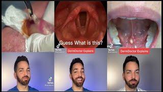 Some of Derm Doctor educational videos | TIKTOk COMPILATION