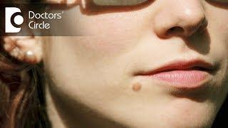 Ways to remove moles on face in late teens - Dr. Rasya Dixit