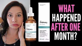 HAIR LOSS SUFFERER REVIEWS THE ORDINARY MULTI-PEPTIDE SERUM FOR HAIR DENSITY Best Hair Growth Serum?