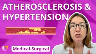 Atherosclerosis and Hypertension - Medical-Surgical - Cardiovascular System | @LevelUpRN