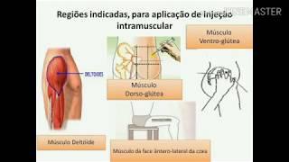 Técnica de Aplicação de Injeção Intramuscular - IM deltóide glúteo vasto lateral da coxa