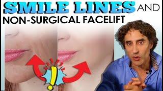 HOW TO GET RID OF SMILE LINES // Smooth LAUGH LINES and MOUTH WRINKLES Before and After