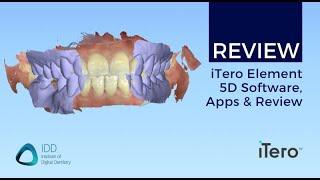 Itero Element 5D Full Arch Scanning as part of our Scanner Review!