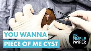 You Wanna Piece of Me Cyst