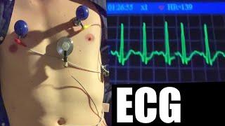 Fast heartbeat sound and ECG monitor