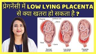 प्रेगनेंसी में LOW LYING PLACENTA से क्या खतरा हो सकता है ? Low lying placenta & Placenta Previa