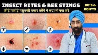 INSECT BITE & BEE STING - How to Cure | कीड़े मकोड़े मधुमखी ततैये ने कटा Dr.Education (Hindi + Eng)