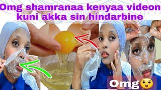 #omg shamranaa kenya videon akka sin hindarbine fulaa kenyaaf bayee waan baredadhaa