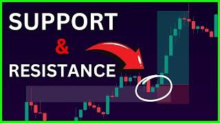 Master Support and Resistance Strategy (ALL YOU NEED TO KNOW)