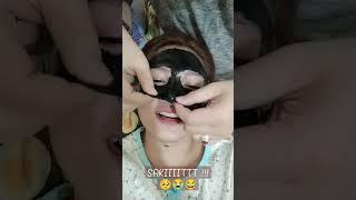 pake masker Naturgo lepasinnya bikin keluar air mata 