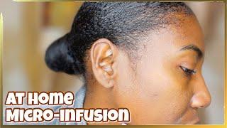 How to Apply Micro Infusion Facial At Home | QURE Micro-Infusion System 2024 | Skincare Routine