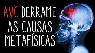 Metafísica da Saúde - AVC Acidente Vascular Cerebral