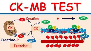 Creatine kinase MB (CK-MB) test and it's significance