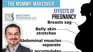 Mommy Makeover Procedure - Matthew Schulman, M.D.