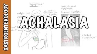 Achalasia (esophageal) - signs and symptoms, pathophysiology, investigations and treatment